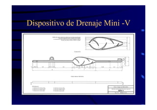 Dispositivo de Drenaje Mini -V
 
