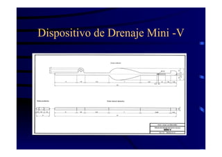 Dispositivo de Drenaje Mini -V
 