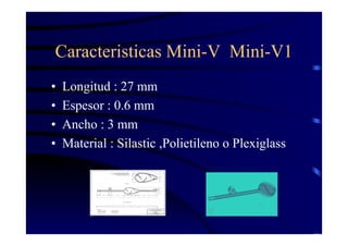 Caracteristicas Mini-V Mini-V1
• Longitud : 27 mm
• Espesor : 0.6 mm
• Ancho : 3 mm
• Material : Silastic ,Polietileno o Plexiglass
 