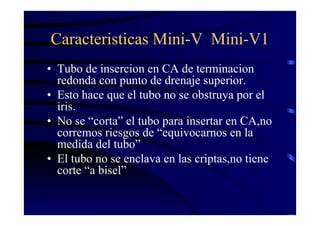 Caracteristicas Mini-V Mini-V1
• Tubo de insercion en CA de terminacion
redonda con punto de drenaje superior.
• Esto hace que el tubo no se obstruya por el
iris.
• No se “corta” el tubo para insertar en CA,no
corremos riesgos de “equivocarnos en la
medida del tubo”
• El tubo no se enclava en las criptas,no tiene
corte “a bisel”
 