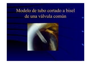 Modelo de tubo cortado a bisel
de una válvula común
 