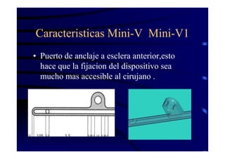 Caracteristicas Mini-V Mini-V1
• Puerto de anclaje a esclera anterior,esto
hace que la fijacion del dispositivo sea
mucho mas accesible al cirujano .
 