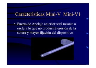 Caracteristicas Mini-V Mini-V1
• Puerto de Anclaje anterior será rasante a
esclera lo que no producirá erosión de la
sutura y mayor fijación del dispositivo
 