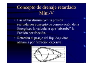 Concepto de drenaje retardado
Mini-V
• Las aletas disminuyen la presión
recibida,por concepto de conservación de la
Energía,es la válvula la que “absorbe” la
Presión por fricción.
• Retardan el pasaje del líquido,evitan
atalamia por filtración excesiva.
 