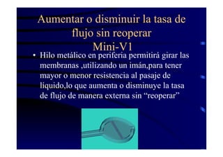 Aumentar o disminuir la tasa de
flujo sin reoperar
Mini-V1
• Hilo metálico en periferia permitirá girar las
membranas ,utilizando un imán,para tener
mayor o menor resistencia al pasaje de
líquido,lo que aumenta o disminuye la tasa
de flujo de manera externa sin “reoperar”
 
