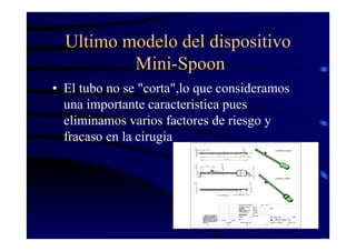 Ultimo modelo del dispositivo
Mini-Spoon
• El tubo no se "corta",lo que consideramos
una importante caracteristica pues
eliminamos varios factores de riesgo y
fracaso en la cirugia
 