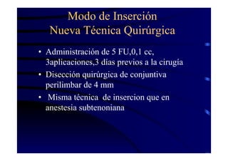 Modo de Inserción
Nueva Técnica Quirúrgica
• Administración de 5 FU,0,1 cc,
3aplicaciones,3 días previos a la cirugía
• Disección quirúrgica de conjuntiva
perilimbar de 4 mm
• Misma técnica de insercion que en
anestesia subtenoniana
 
