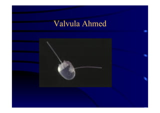 Valvula Ahmed
 