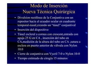 Modo de Inserción
Nueva Técnica Quirúrgica
• Divulsion rectilínea de la Conjuntiva con un
repositor hacia el ecuador ocular en cuadrante
temporal-nasal,creando un “túnel” conjuntival
• Inserción del dispositivo
• Túnel escleral a cornea con crescent,entrada con
aguja 25 G en CA , inserción del tubo en
CA,medición de la altura del tubo en CA ,sutura a
esclera en puerto anterior de válvula con Nylon
10.0
• Cierre de conjuntiva con Vycril 7-0 o Nylon 10-0
• Tiempo estimado de cirugía 15 minutos
 