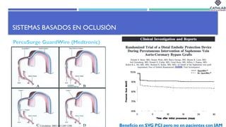 Guardwire Dispositivos de Extracción de trombo y manejo del fenómeno del no ...
