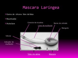 Mascara LaríngeaINDICACIONES:Procedimientos de  urgencia en reemplazo  mascara