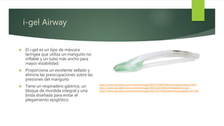 i-gel Airway
 El i-gel es un tipo de máscara
laríngea que utiliza un manguito no
inflable y un tubo más ancho para
mayor estabilidad.
 Proporciona un excelente sellado y
elimina las preocupaciones sobre las
presiones del manguito
 Tiene un respiradero gástrico, un
bloque de mordida integral y una
brida diseñada para evitar el
plegamiento epiglótico.
https://www.uptodate.com/contents/images/EM/107885/Placementigelairwayvid.mp4
https://www.uptodate.com/contents/images/EM/110719/Swiveladaptervid.mp4
https://www.uptodate.com/contents/images/EM/110720/Endointubsupraglotticvid.mp4
 