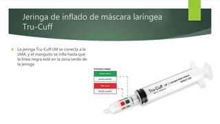 Jeringa de inflado de máscara laríngea
Tru-Cuff
 La jeringa Tru-Cuff LM se conecta a la
LMA, y el manguito se infla hasta que
la línea negra esté en la zona verde de
la jeringa.
 