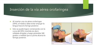 Inserción de la vía aérea orofaríngea
 Al insertar una vía aérea orofaríngea
(OPA), el médico debe evitar empujar la
lengua hacia la faringe posterior.
 Esto se puede lograr comenzando con la
curva del OPA invertida (es decir,
cefalada dirigida) y luego girándola 180
grados a medida que su punta alcanza la
faringe posterior.
 