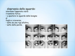 disprassia dello sguardo:
interessa l’apparato visivo
il bambino fatica
• a spostare lo sguardo dalla lavagna
al
foglio e viceversa,
• salta da una riga all’altra,
• salta delle parole.
 