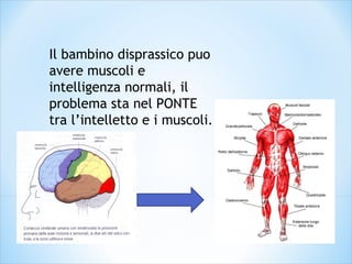 Il bambino disprassico puo
avere muscoli e
intelligenza normali, il
problema sta nel PONTE
tra l’intelletto e i muscoli.
 