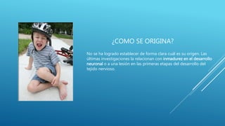 ¿COMO SE ORIGINA?
No se ha logrado establecer de forma clara cuál es su origen. Las
últimas investigaciones la relacionan con inmadurez en el desarrollo
neuronal o a una lesión en las primeras etapas del desarrollo del
tejido nervioso.
 