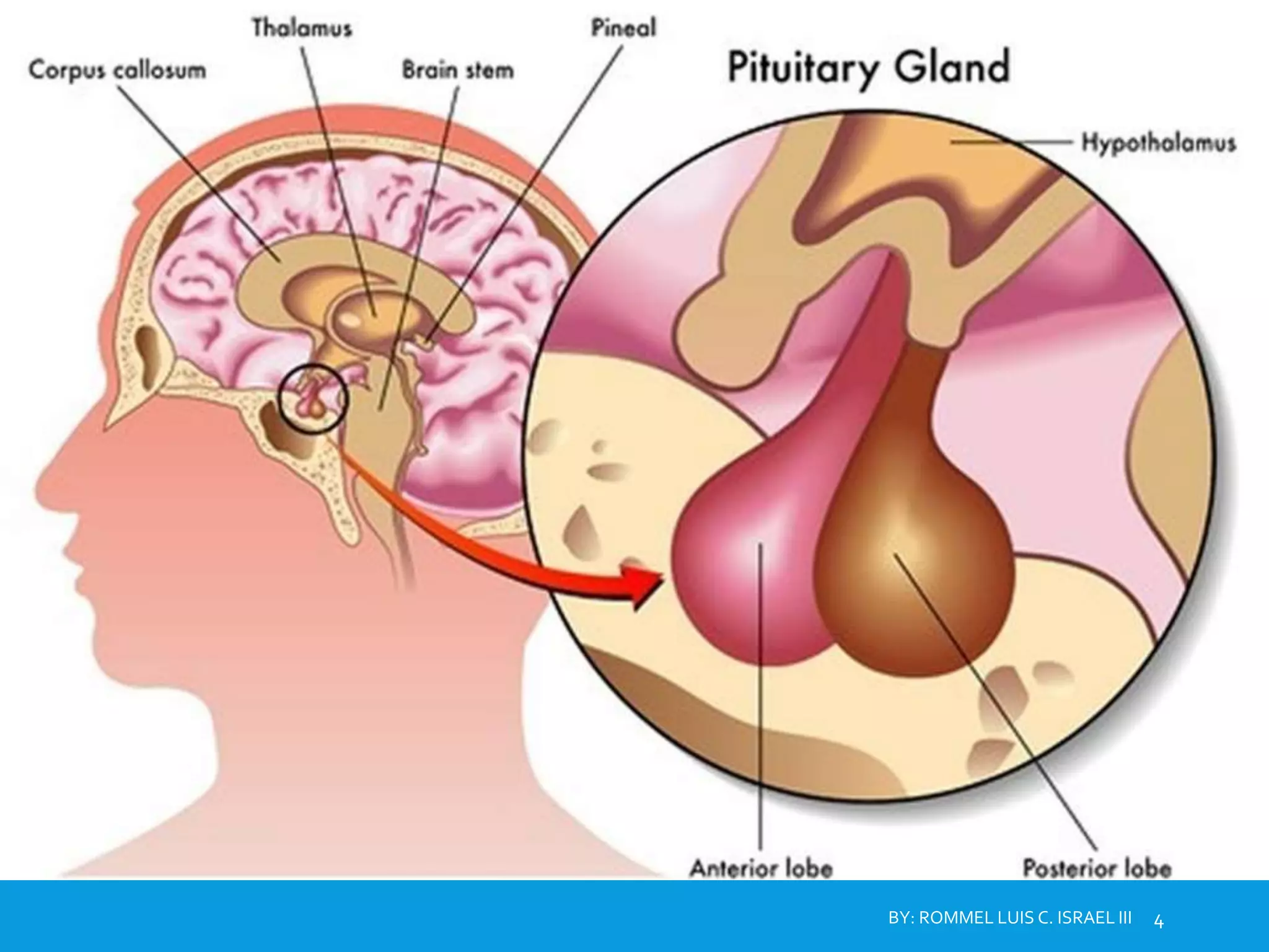 disorders-of-the-pituitary-gland-ppt