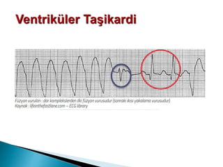 Di̇sri̇tmi̇  DocDrMuratAyan