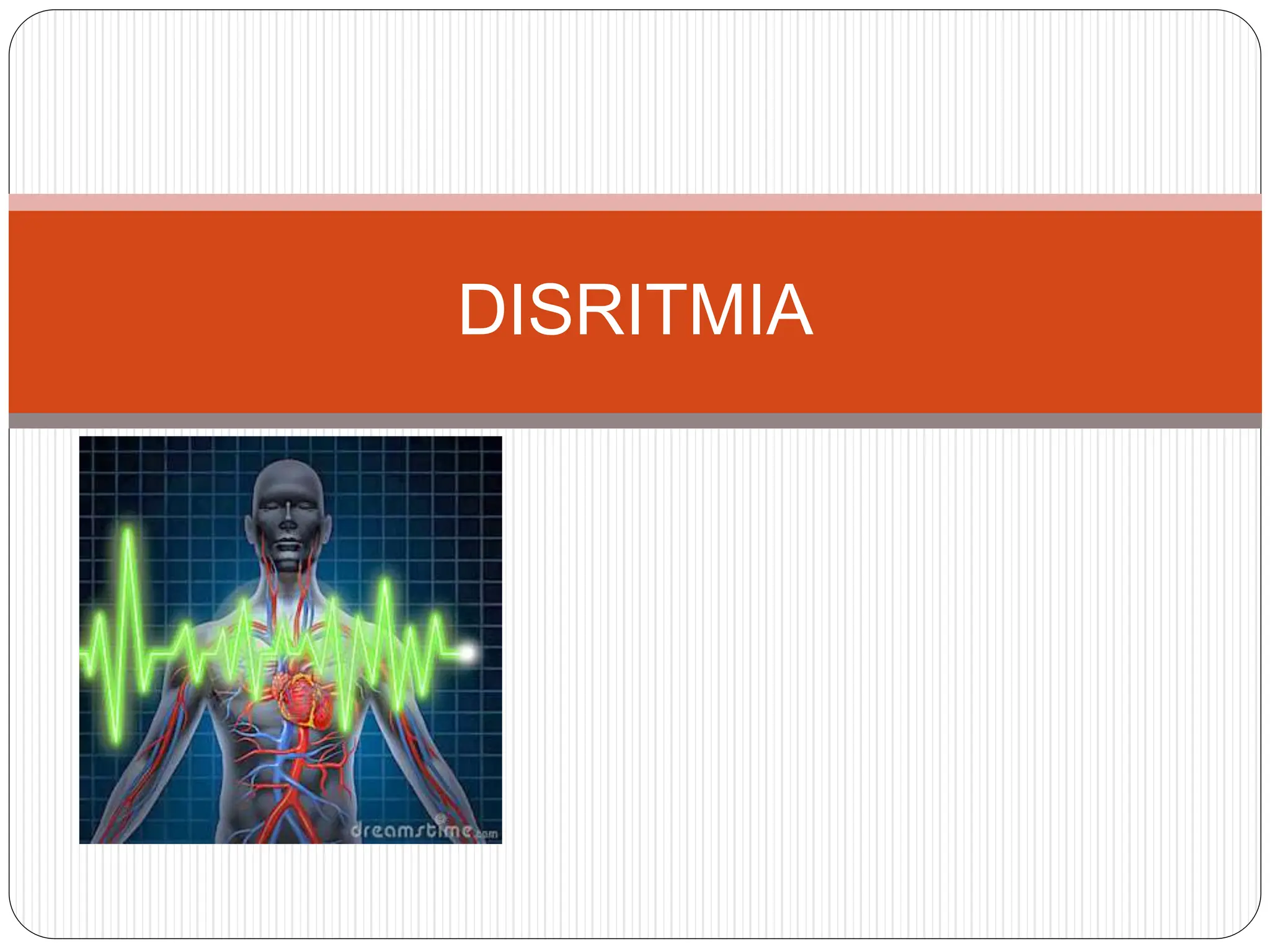 DISRITMIA.pptx