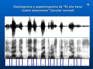   Oscilograma y espectrograma de "El año tiene cuatro estaciones" (locutor normal) 