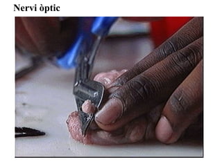 Nervi òptic
 