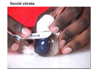 Secció còrnia
 