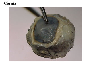 Còrnia
 