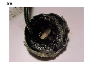 Iris
 