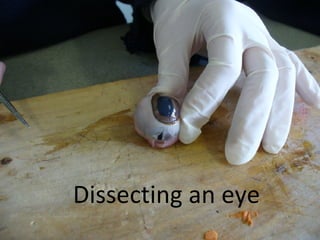 Dissecting an eye 