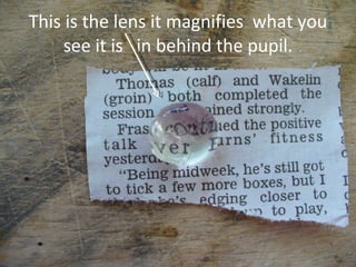 This is the lens it magnifies  what you see it is  in behind the pupil. 