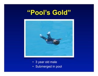 “Pool’s Gold”




 • 3 year old male
 • Submerged in pool
 