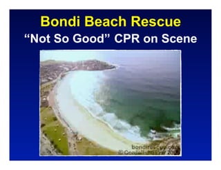 Bondi Beach Rescue
“Not So Good” CPR on Scene
 
