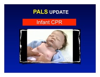 PALS UPDATE
 Infant CPR
 