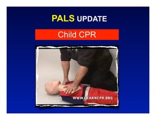 PALS UPDATE
 Child CPR
 