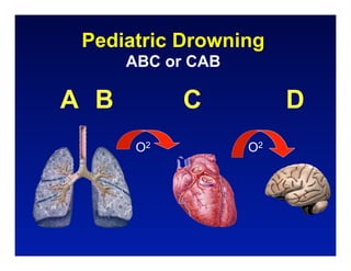 Pediatric Drowning
      ABC or CAB

A B         C           D
       O2          O2
 