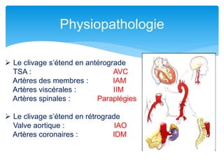 Physiopathologie
 Le clivage s’étend en antérograde
TSA : AVC
Artères des membres : IAM
Artères viscérales : IIM
Artères spinales : Paraplégies
 Le clivage s’étend en rétrograde
Valve aortique : IAO
Artères coronaires : IDM
 