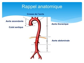 Rappel anatomique
Culot aortique
Aorte ascendante
Crosse de l’aorte
Aorte thoracique
Aorte abdominale
 