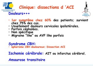 Clinique: dissections d ’ACI
Douleurs+++
• 1er symptôme chez 60% des patients; survient
chez 75% des cas.
• Usuellement douleurs cervicales ipsilatérales.
• Parfois céphalées.
• Non spécifique
• Migraine “like” ou AVF like parfois
Syndrome CBH:
• aphorisme CBH douloureux: Dissection ACI
Ischemie cérébrale: AIT ou infarctus cérébral.
Amaurose transitoire
 