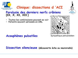 Clinique: dissections d ’ACI
Paralysie des derniers nerfs crâniens
[IX, X, XI, XII ]
• Toutes les combinaisons peuvent se voir
• Patients souvent adressés en ORL
Acouphènes pulsatiles
Dissection silencieuse (découverte écho ou neuroradio)
Sympathique péricarotidien
 