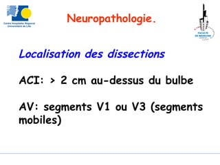 Neuropathologie.
Localisation des dissections
ACI: > 2 cm au-dessus du bulbe
AV: segments V1 ou V3 (segments
mobiles)
 