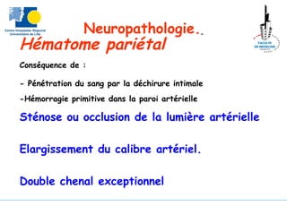 Neuropathologie.
Hématome pariétal
Conséquence de :
- Pénétration du sang par la déchirure intimale
-Hémorragie primitive dans la paroi artérielle
Sténose ou occlusion de la lumière artérielle
Elargissement du calibre artériel.
Double chenal exceptionnel
 