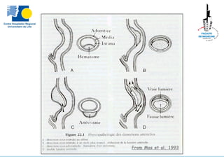 From Mas et al. 1993
 