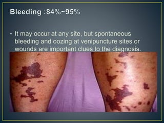 • It may occur at any site, but spontaneous
bleeding and oozing at venipuncture sites or
wounds are important clues to the diagnosis.
 