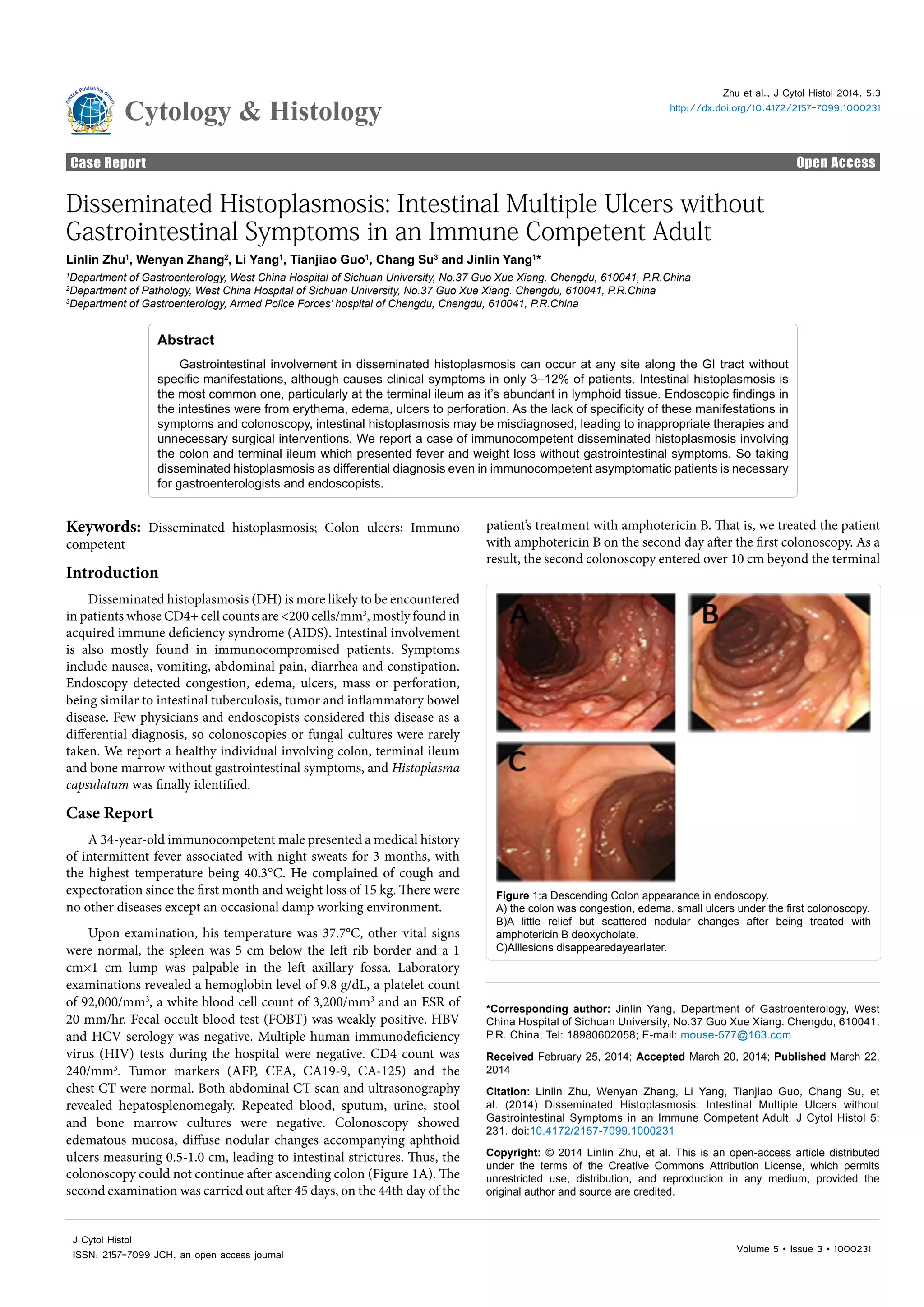 Picture Idea: Disseminated Histoplasmosis Intestinal Multiple Ulcers Without