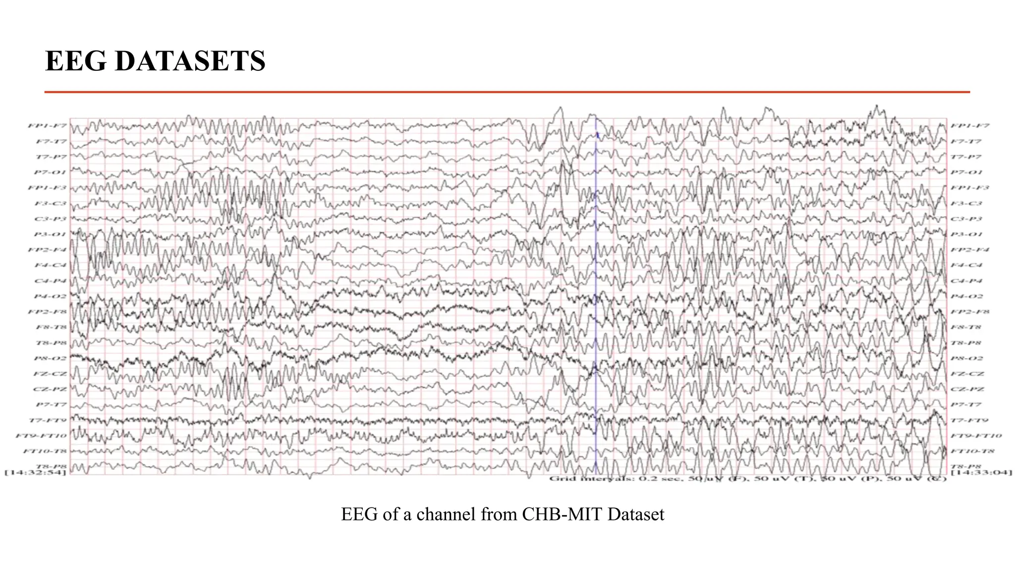 EEG DATASETS
EEG of a channel from CHB-MIT Dataset
 