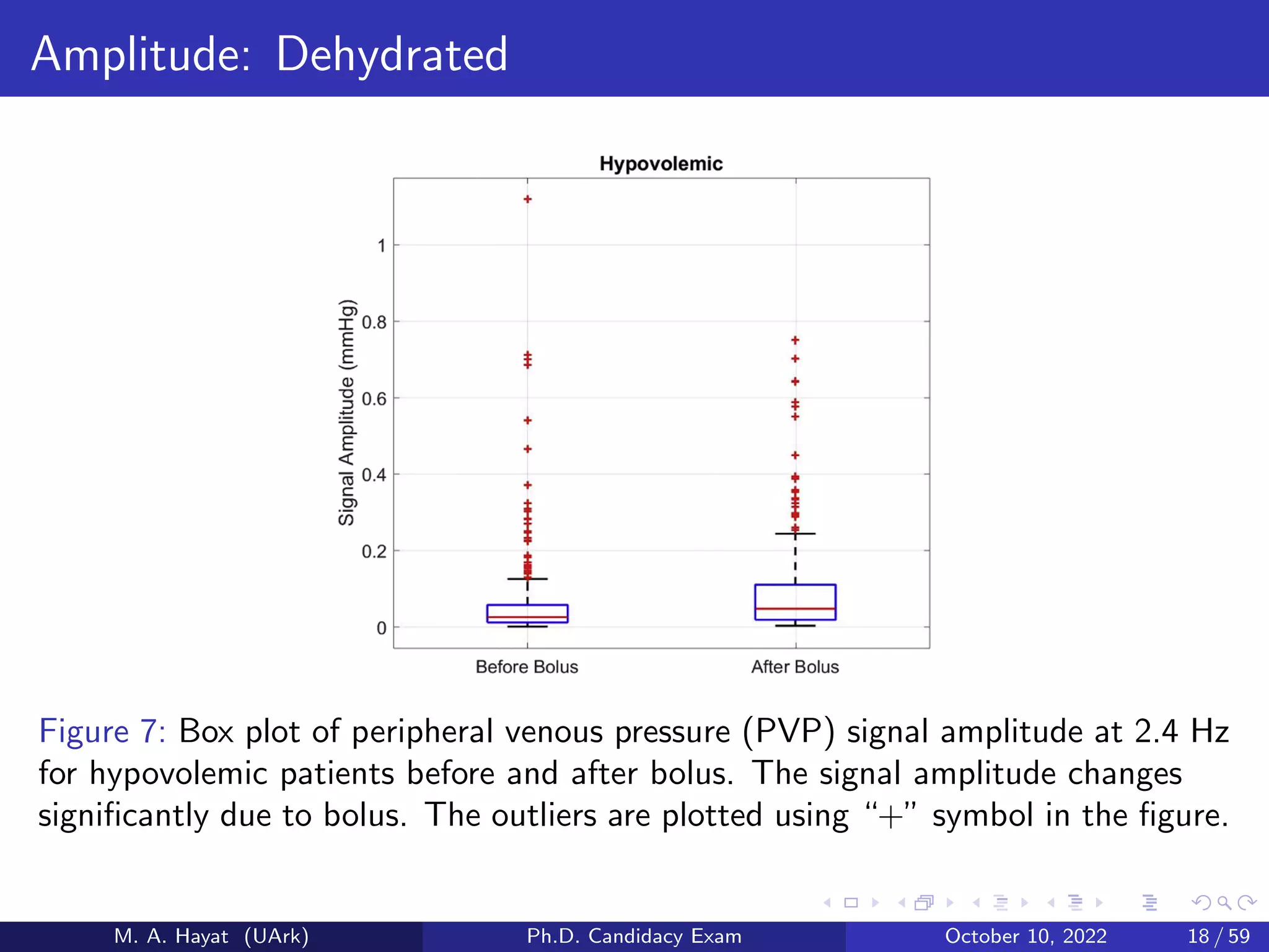Amplitude: Dehydrated
Figure 7: Box plot of peripheral venous pressure (PVP) signal amplitude at 2.4 Hz
for hypovolemic patients before and after bolus. The signal amplitude changes
significantly due to bolus. The outliers are plotted using “+” symbol in the figure.
M. A. Hayat (UArk) Ph.D. Candidacy Exam October 10, 2022 18 / 59
 