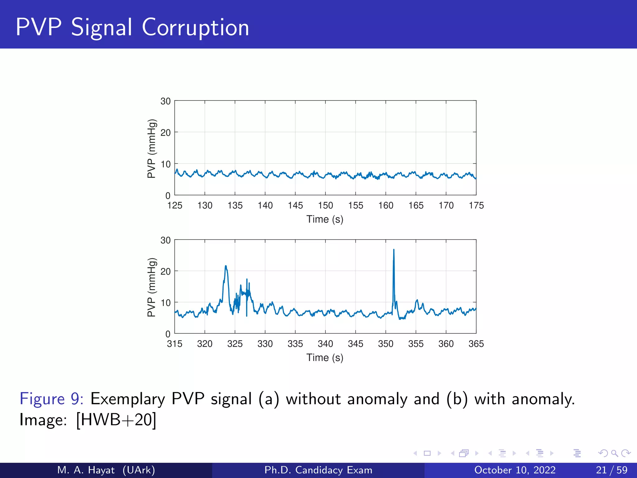 PVP Signal Corruption
125 130 135 140 145 150 155 160 165 170 175
Time (s)
0
10
20
30
PVP
(mmHg)
315 320 325 330 335 340 345 350 355 360 365
Time (s)
0
10
20
30
PVP
(mmHg)
Figure 9: Exemplary PVP signal (a) without anomaly and (b) with anomaly.
Image: [HWB+20]
M. A. Hayat (UArk) Ph.D. Candidacy Exam October 10, 2022 21 / 59
 