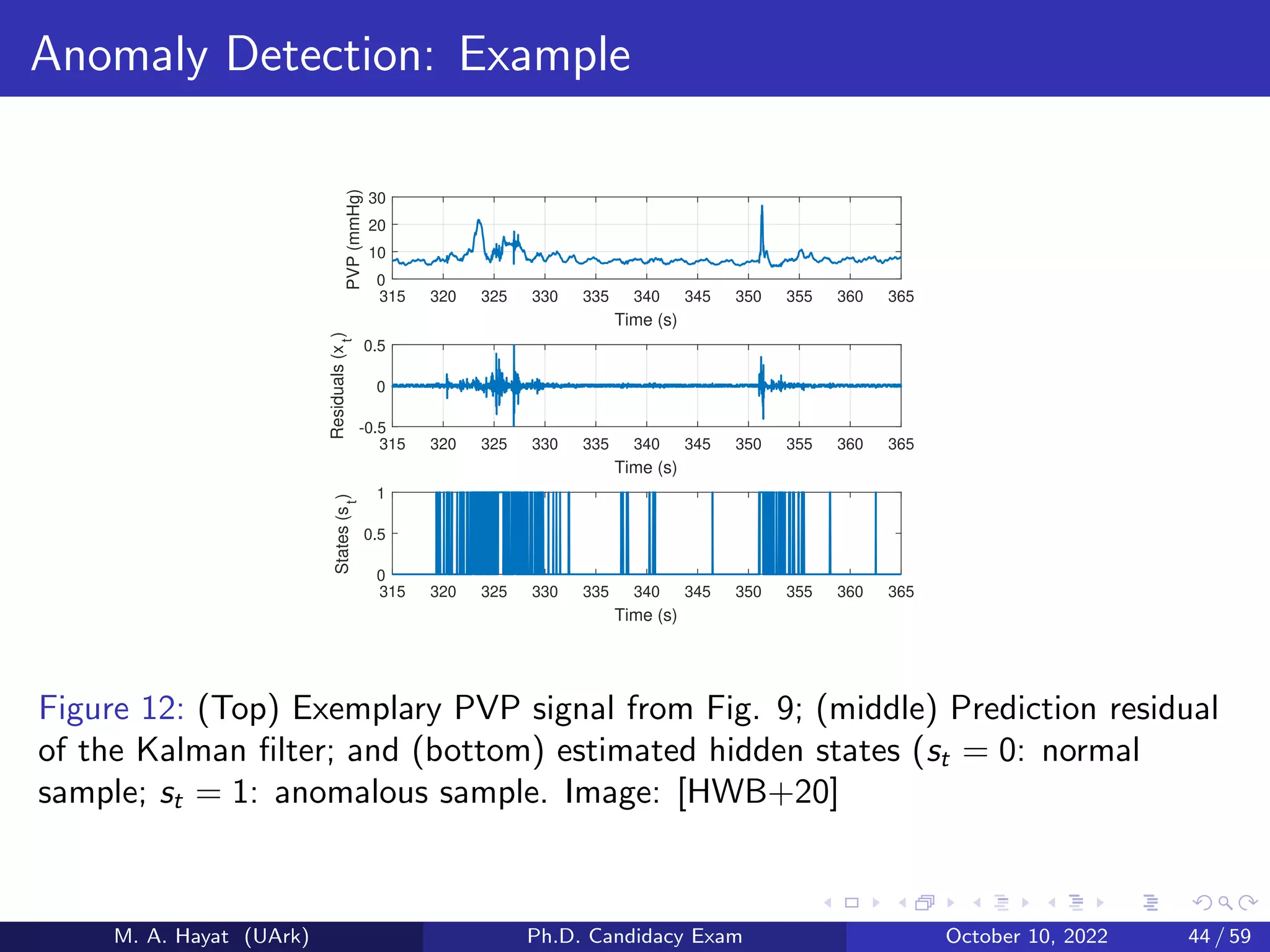 Anomaly Detection: Example
315 320 325 330 335 340 345 350 355 360 365
Time (s)
0
10
20
30
PVP
(mmHg)
315 320 325 330 335 340 345 350 355 360 365
Time (s)
-0.5
0
0.5
Residuals
(x
t
)
315 320 325 330 335 340 345 350 355 360 365
Time (s)
0
0.5
1
States
(s
t
)
Figure 12: (Top) Exemplary PVP signal from Fig. 9; (middle) Prediction residual
of the Kalman filter; and (bottom) estimated hidden states (st = 0: normal
sample; st = 1: anomalous sample. Image: [HWB+20]
M. A. Hayat (UArk) Ph.D. Candidacy Exam October 10, 2022 44 / 59
 