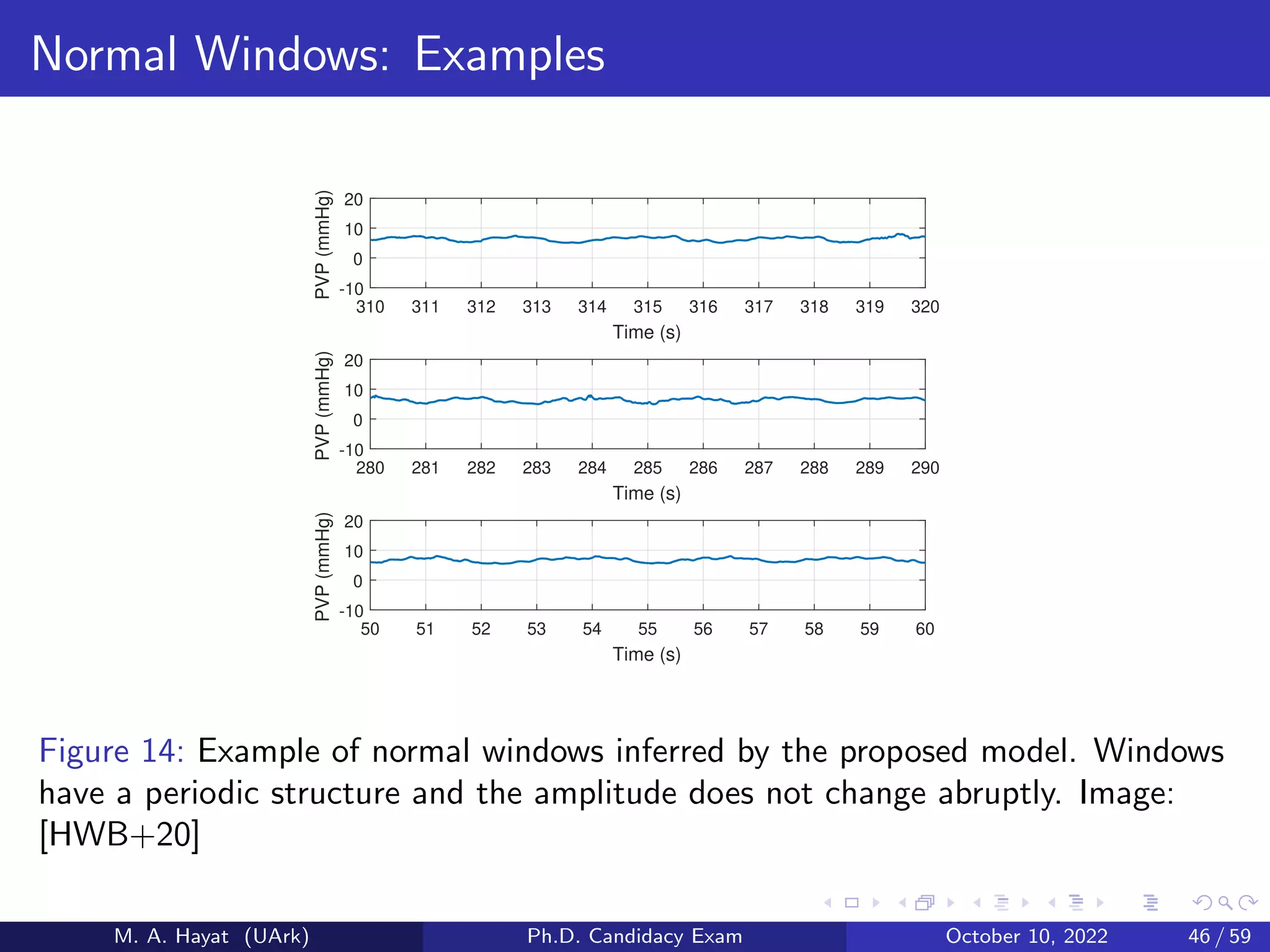 Normal Windows: Examples
310 311 312 313 314 315 316 317 318 319 320
Time (s)
-10
0
10
20
PVP
(mmHg)
280 281 282 283 284 285 286 287 288 289 290
Time (s)
-10
0
10
20
PVP
(mmHg)
50 51 52 53 54 55 56 57 58 59 60
Time (s)
-10
0
10
20
PVP
(mmHg)
Figure 14: Example of normal windows inferred by the proposed model. Windows
have a periodic structure and the amplitude does not change abruptly. Image:
[HWB+20]
M. A. Hayat (UArk) Ph.D. Candidacy Exam October 10, 2022 46 / 59
 